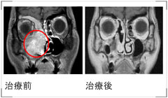 治療前→治療後