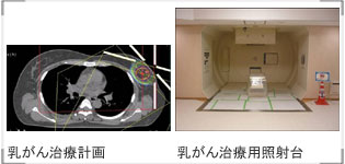 乳がん治療計画：乳がん治療用照射台