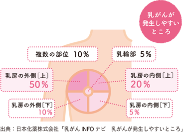 乳がんが発生しやすいところ