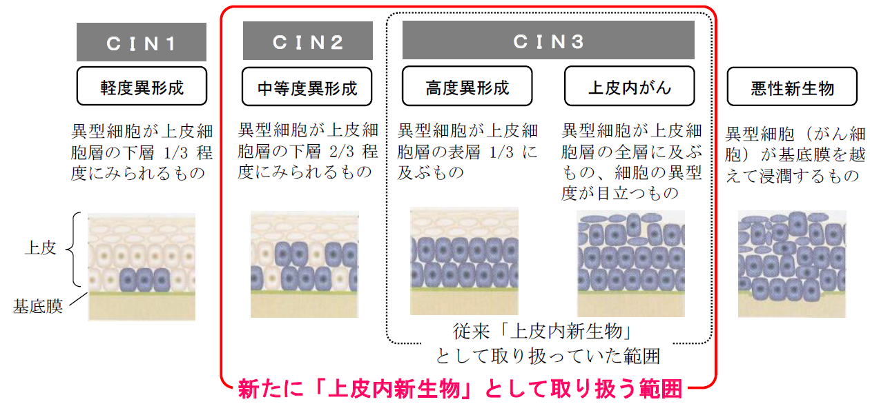 子宮頚部異形成